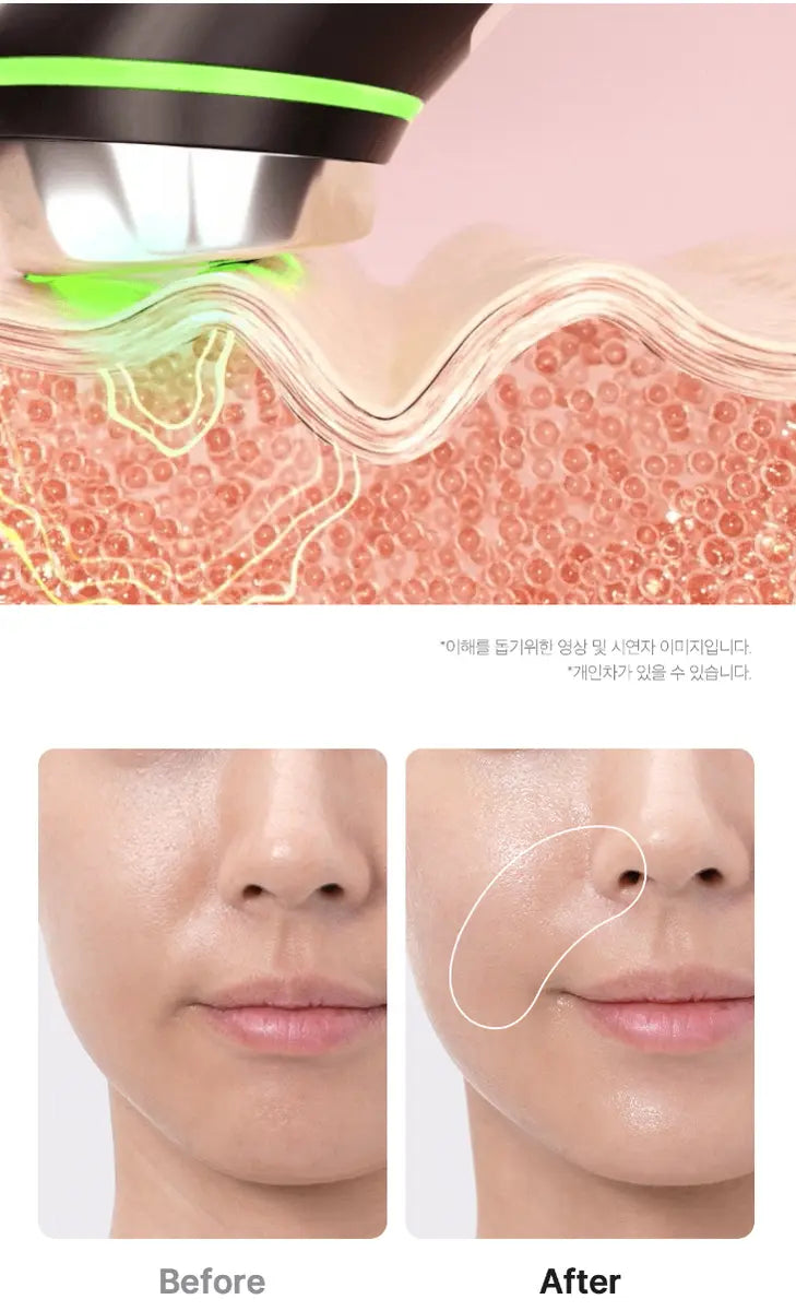Medicube AGE-R Booster Pro: Unlocking Youthful Radiance Medicube AGE-R Booster Pro: Unlocking Youthful Radiance